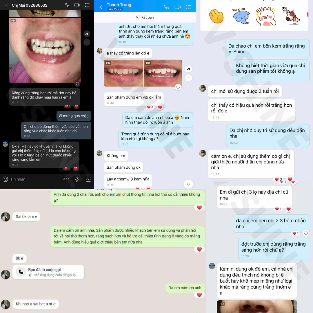 Ảnh thực tế răng trắng sáng của khách hàng